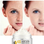 Kojic Acid Face Cream, Evens Out Skin Tone, Eliminates Dark Spots and Dullness - Non-Greasy, Suitable for Both Men and Women - Whitening and Moisturizing Cream, for Day and Night Use